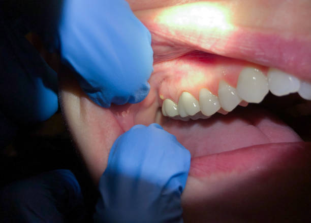 Dentist for Dental Trauma in NC